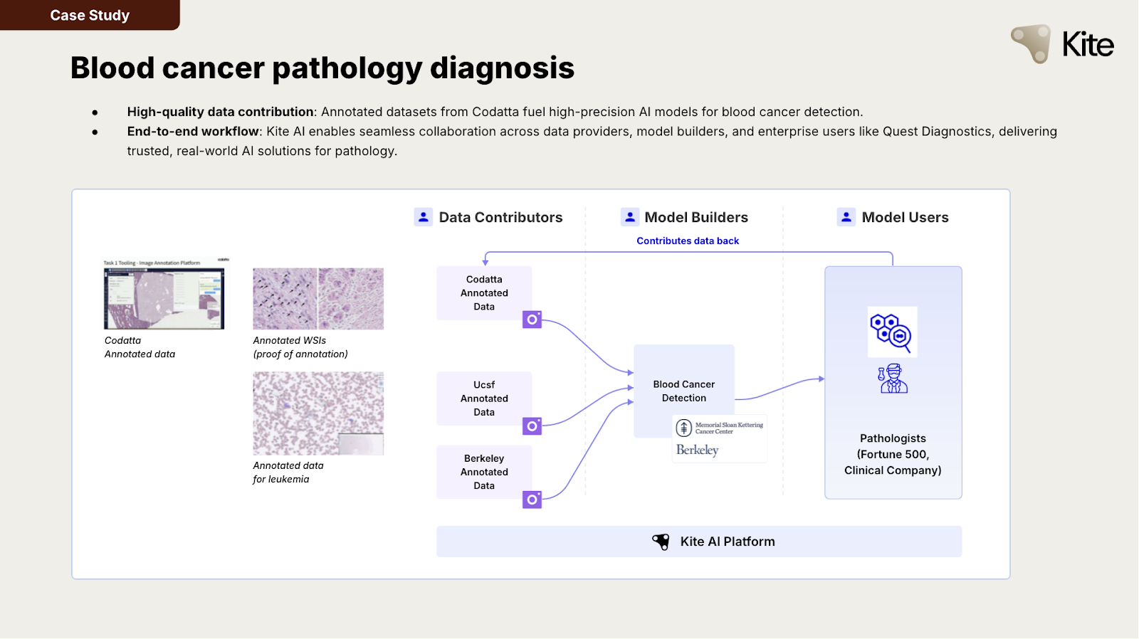 How KITE AI leverages its modular ecosystem to drive AI value growth: CodattaRecommended Articles